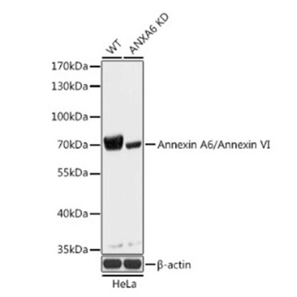 Антитела [KO Validated] ANXA6 кроличьи, поликлональные