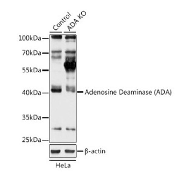 Антитела [KO Validated] Adenosine Deaminase (ADA) кроличьи, поликлональные