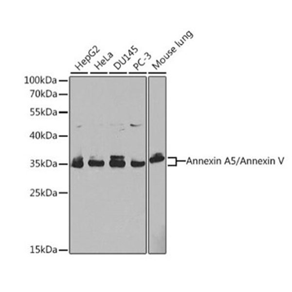 Антитела [KO Validated] Annexin A5/Annexin V кроличьи, поликлональные