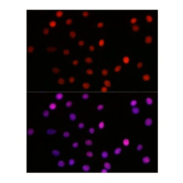 Антитела [KO Validated] Acetyl-HMGB1-K29 кроличьи, поликлональные