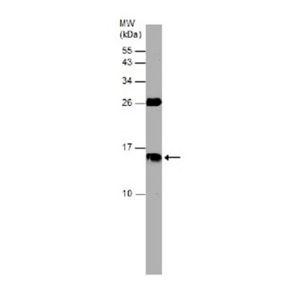 Антитела Anti-Cystatin C antibody, кроличьи поликлональные